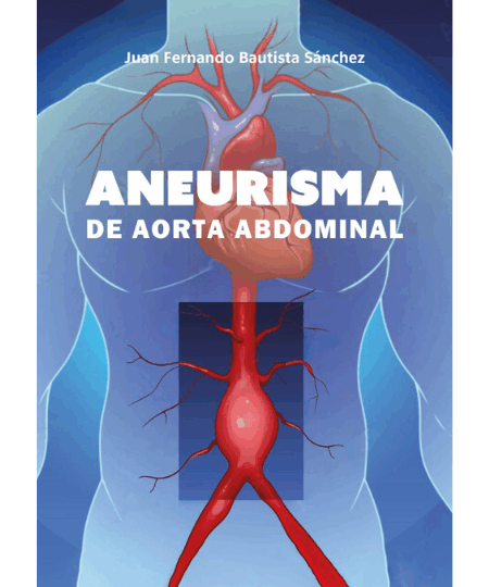 Aneurisma de aorta abdominal – Fondo editorial
